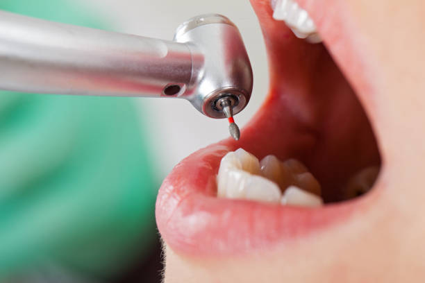 Fast & Reliable Emergency Dental Services in MT
